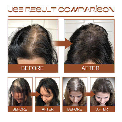 Batana Oil Conditioner Nourishing And Repairing The Hair Root Strengthening And Anti-fall Soft And Dense Hair Fixing Volume