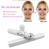 Blue Light Acne Therapy Pen – Laser Device for Acne, Scars & Wrinkle Removal
