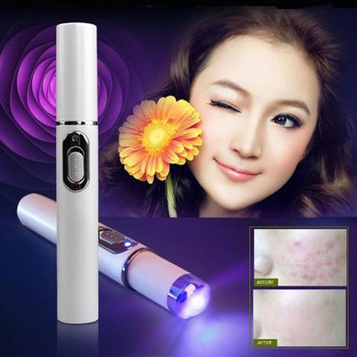 Blue Light Acne Therapy Pen – Laser Device for Acne, Scars & Wrinkle Removal