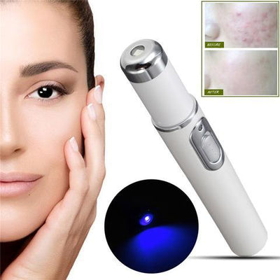 Blue Light Acne Therapy Pen – Laser Device for Acne, Scars & Wrinkle Removal